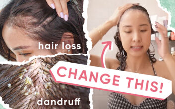 4 Reasons Why Your Hair Loss and Dandruff Aren’t Getting Better, Plus 5 Tips!