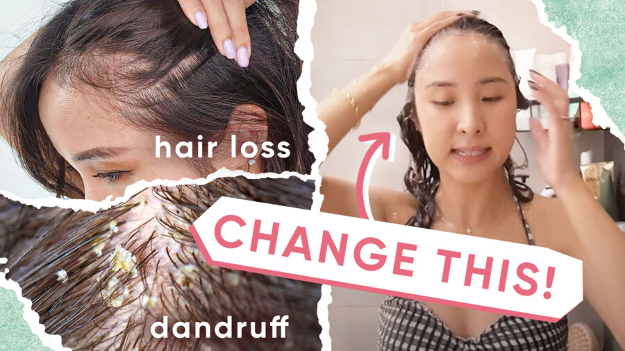 4 Reasons Why Your Hair Loss and Dandruff Aren’t Getting Better, Plus 5 Tips!