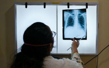 Illegal Immigrant Children With Tuberculosis Released Across US