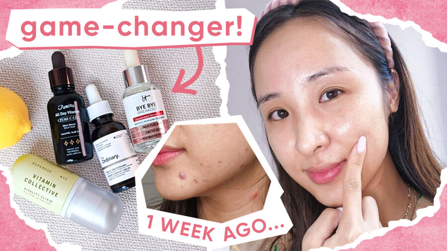 4 Best Brightening Serums: Vitamin C, Acne, and Hyperpigmentation!