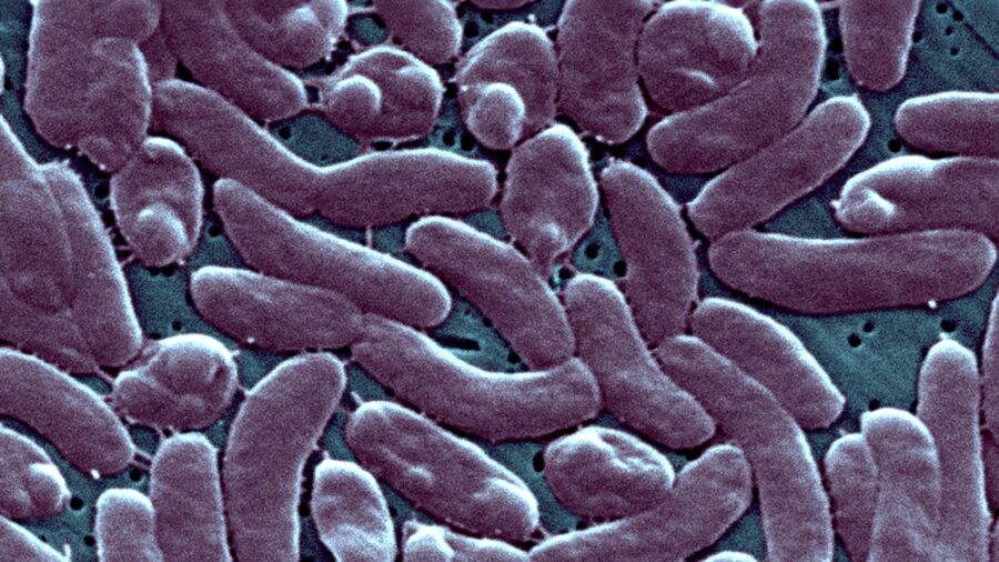 3 People Have Died After Infection With Rare Flesh-Eating Bacteria in Connecticut and New York