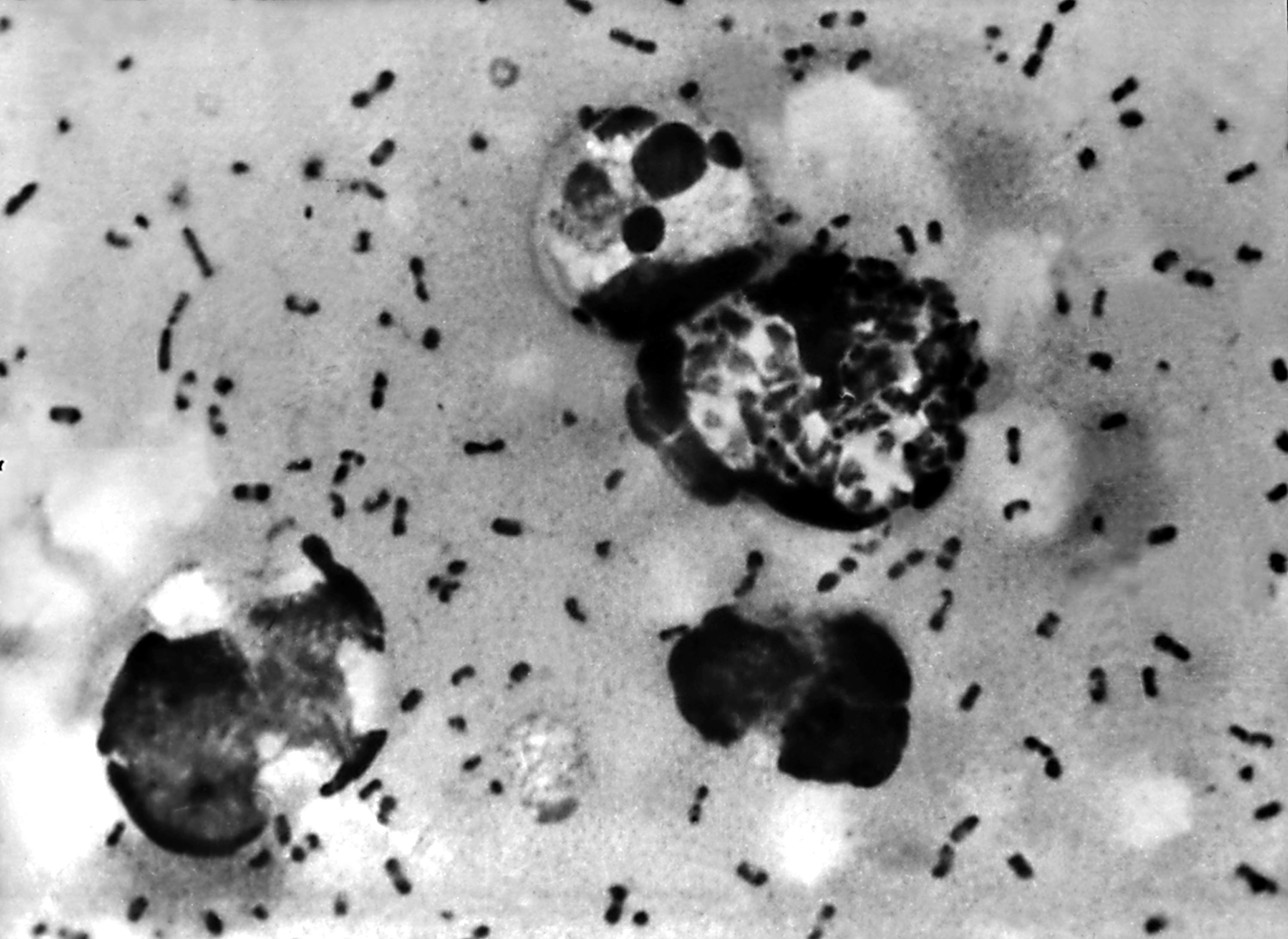 Oregon Reports First Human Case of Bubonic Plague in Nearly a Decade NTD