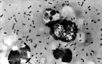 Oregon Reports First Human Case of Bubonic Plague in Nearly a Decade