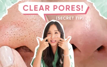 My ‘No Fail’ Routine for Blackheads, Large Pores, and Acne
