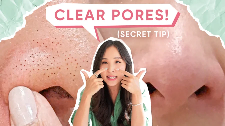 My 'No Fail' Routine for Blackheads, Large Pores, and Acne