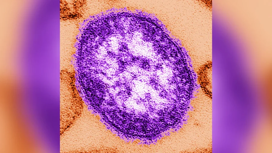 Health Officials Confirm South Carolina Measles Case Linked to Flight Exposure