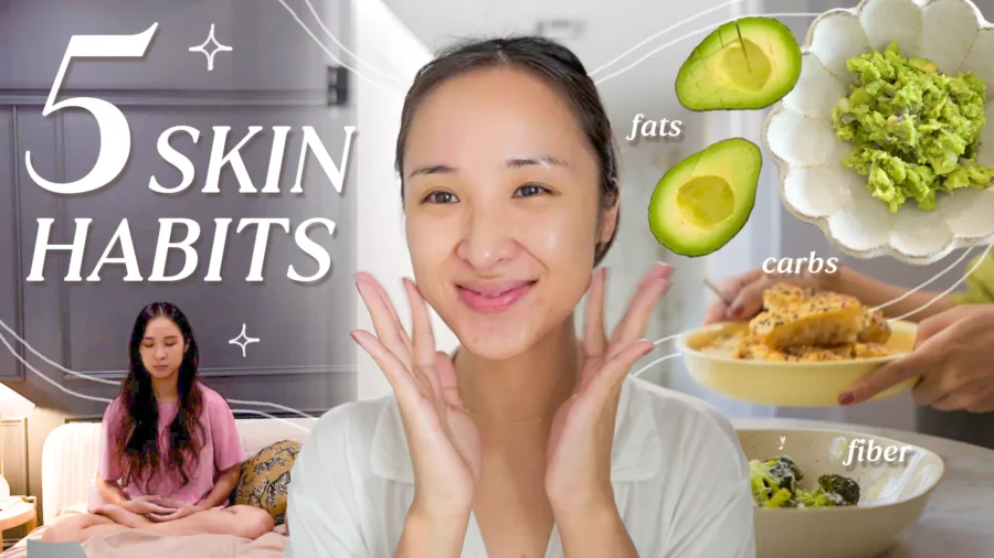 5 Things That Transformed My Hormonal Acne | Skincare, Food, and More!