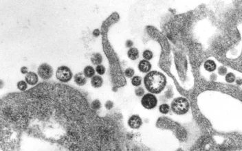 Death From Lassa Virus Reported in US