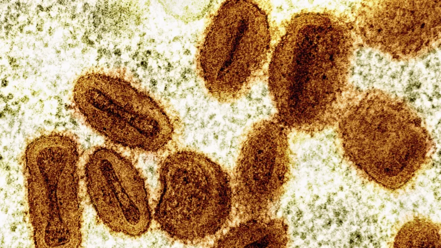 US Health Officials Report 1St Case of New Form of Mpox in Traveler