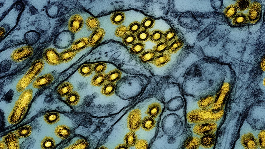 Chinese Doctor Warns of Human Bird Flu Infections