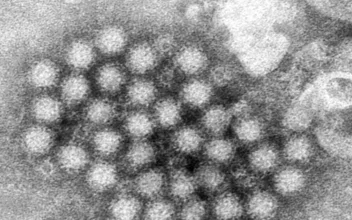 Norovirus Cases Are Surging in Parts of US, CDC Data Shows