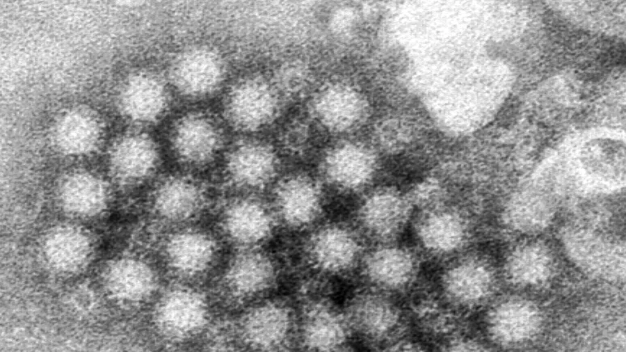 Norovirus Cases Are Surging in Parts of US, CDC Data Shows