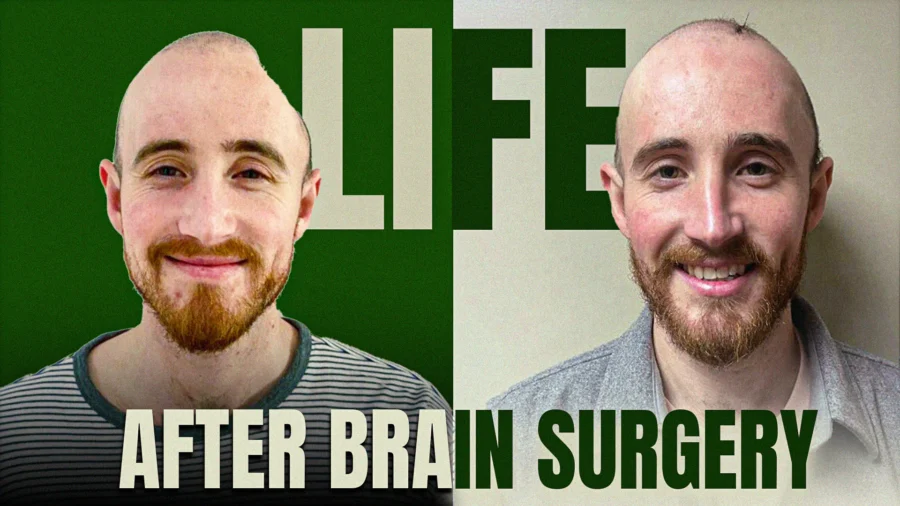Window to Brain’ ADVANCES Brain-Tumor, Brain Injury Treatment
