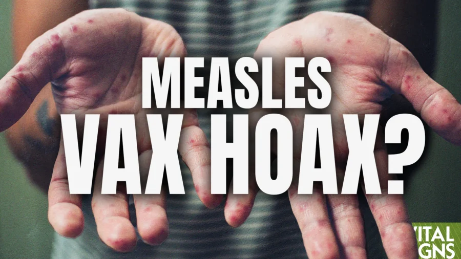 Did the MMR Vax Really End Measles in the US? How Do Vaxxed Kids Compare to Unvaxxed Kids in Health?