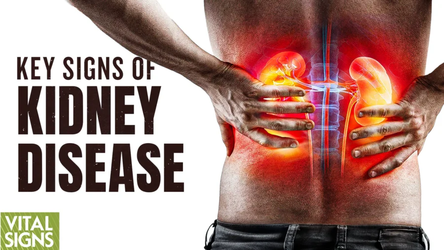 Cut Kidney Inflammation Risk via the Fasting Mimicking Diet | Dr. Jason Fung