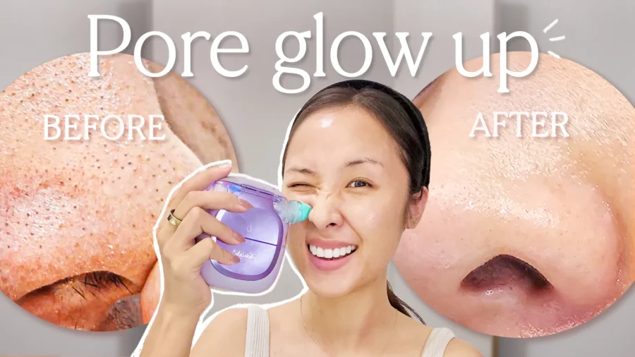 My Weekly Pore Glow Up: How I Unclog Large Pores and Soften Texture (Ft. Shark FacialPro Glow)