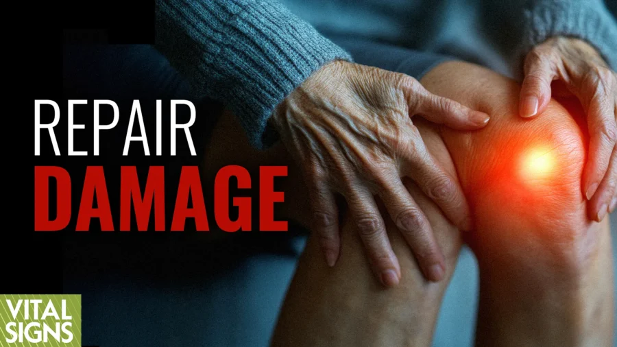 Ease Arthritis: Supplements to Surgery | Orthopedic Surgeon