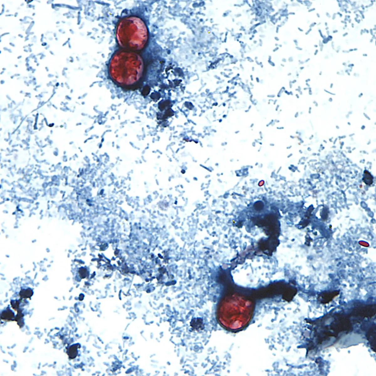 Doctors, Health Experts Weigh In on How to Stay Safe Amid Cyclosporiasis Outbreak