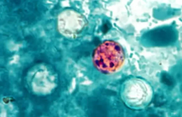 Cyclospora cayetanensis oocysts in a stool sample, in a file image. (CDC via The Epoch Times)