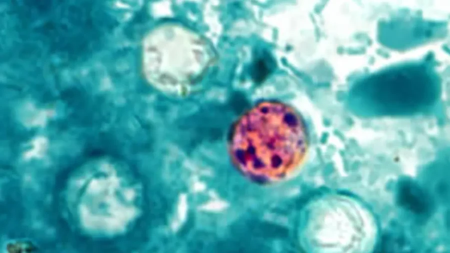 Cyclosporiasis Outbreak Now Linked to 9 States, CDC Says