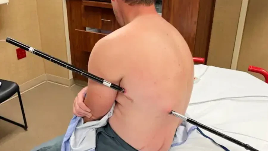Impaled Montana Man Hikes to Safety From Granite Peak