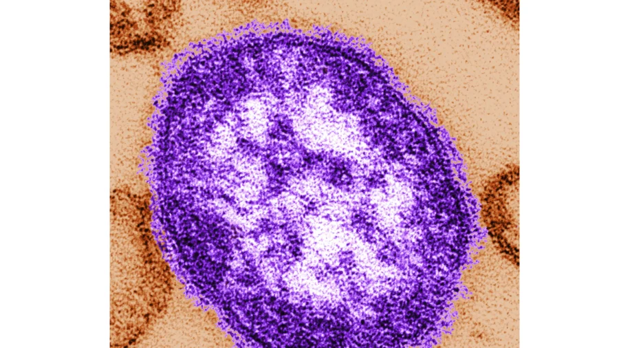 Indiana Warns of Measles Exposure at the Zoo