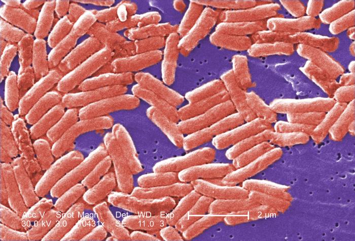 Los Angeles Restaurant Closes After 10 Confirmed Cases of Salmonella